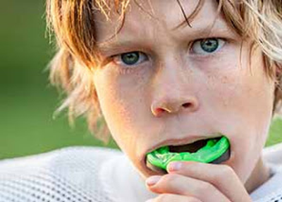 Tooth Aligners Tampa