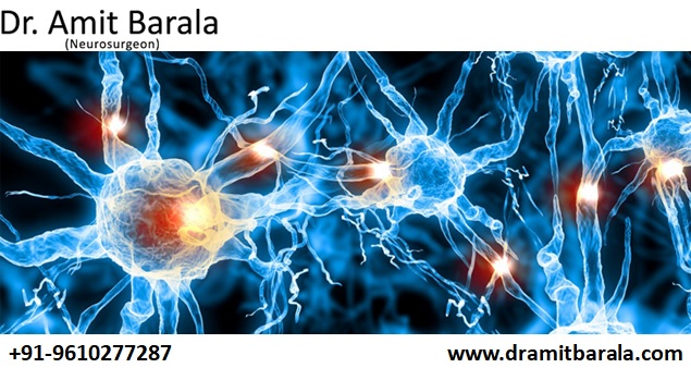 Best Neurosurgeon in Jaipur