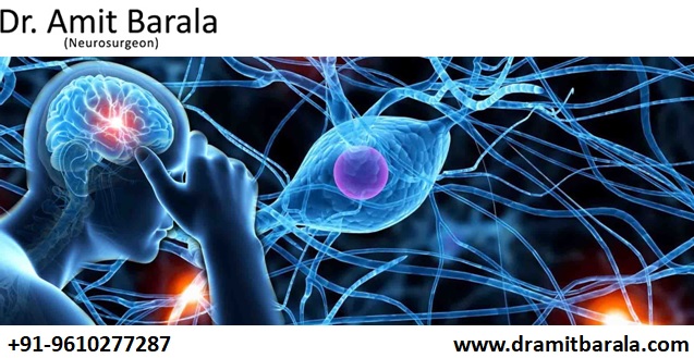 Neurologist Best Doctor in Jaipur