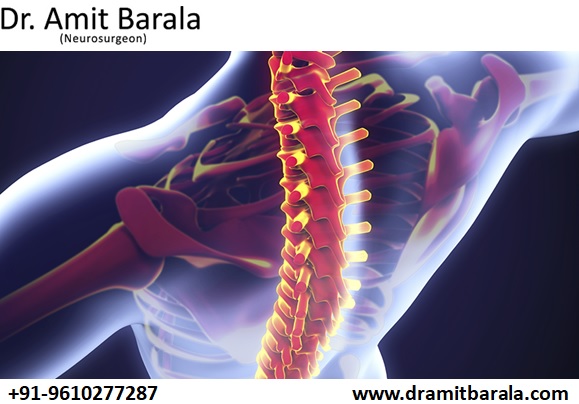 Best Neurology Hospital in Jaipur