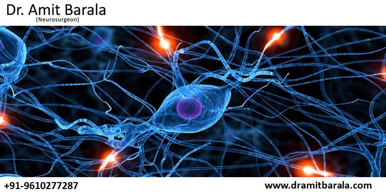 Best Neurosurgeon Doctor in Jaipur