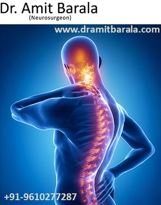 Best Neurosurgeon in Jaipur