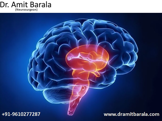Neurologist Best Doctor in Jaipur
