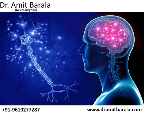Best Neurosurgeon in Jaipur