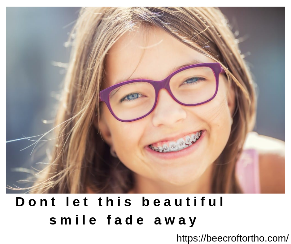 Get Braces for Kids