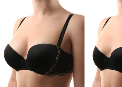 Best Breast Augmentation in Denver, CO