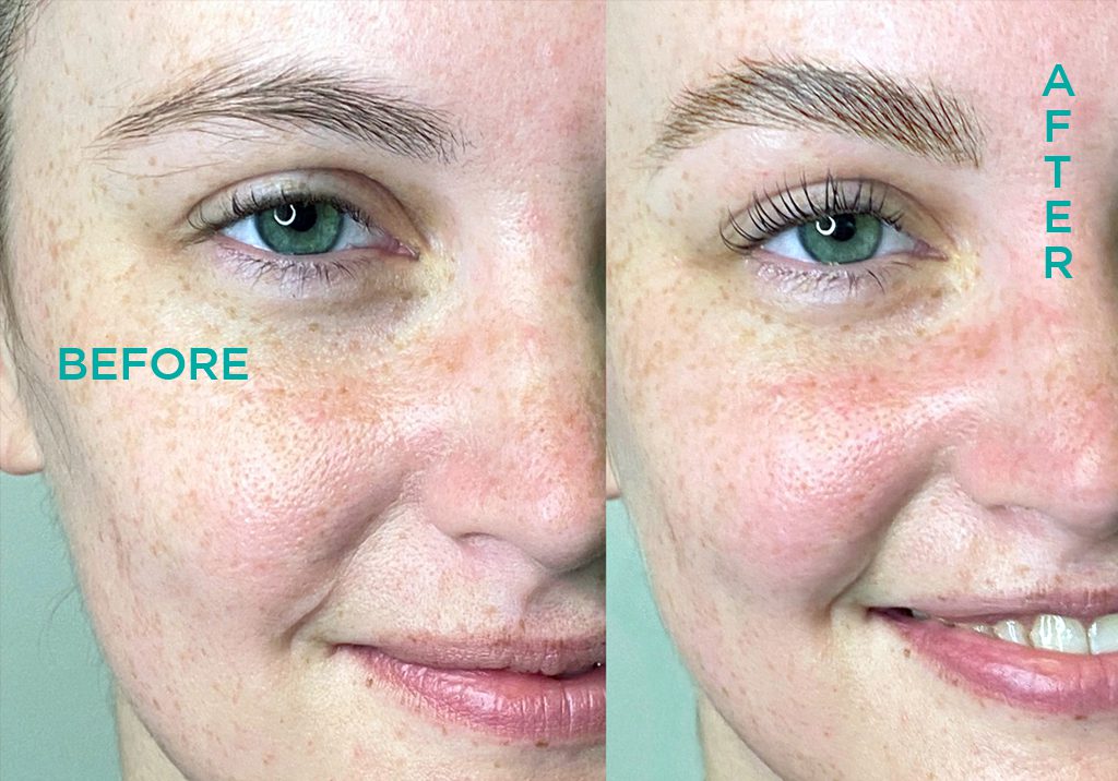 Brow Lamination