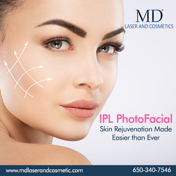 IPL PhotoFacial To Recover Your Damaged Skin Caused By Sunlight