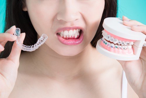 Invisible braces In hawaii