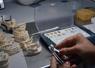 The Options for Inexpensive Dental Implants