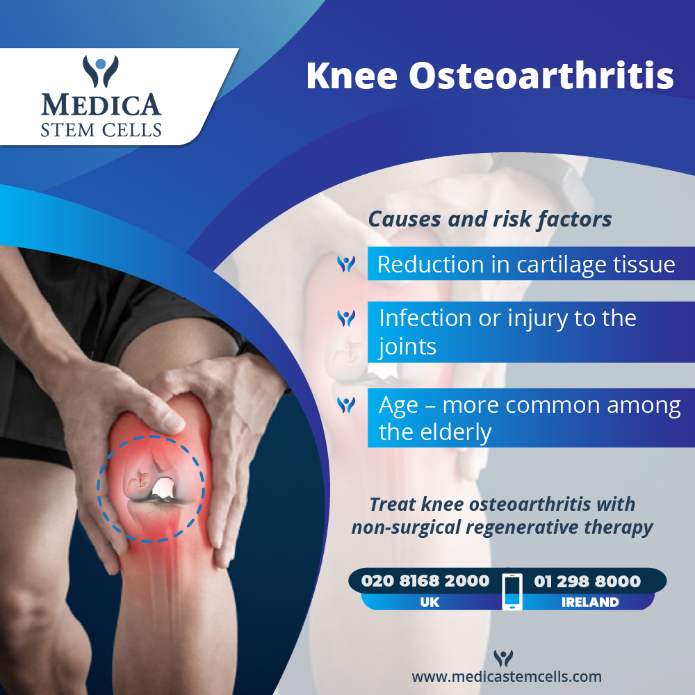 Regenerative Cell Treatment - Knee ostearthritis