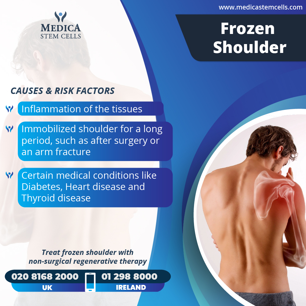 Regenerative treatment for Frozen shoulder