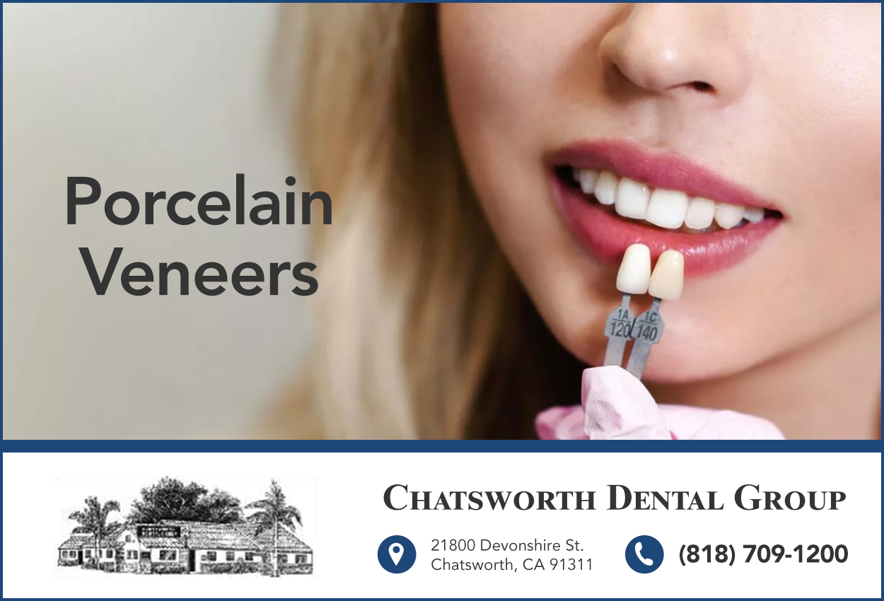 Dental Veneers Near Me | Chatsworth Dental Group