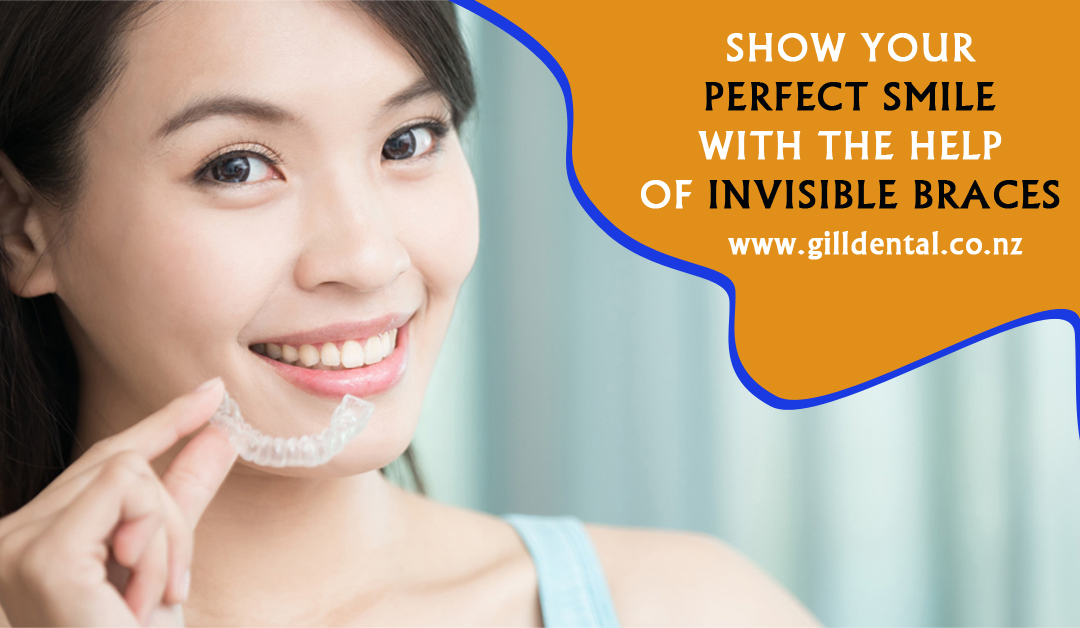 Invisible Braces
