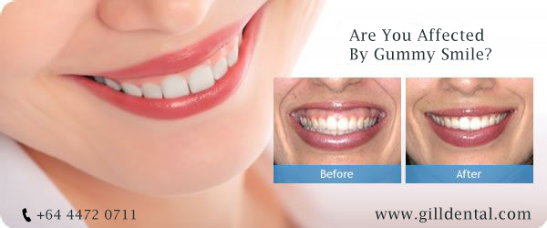 Surgical Dentistry in Newzealand