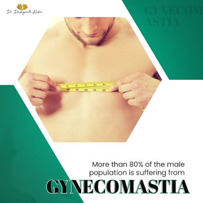 Best Gynecomastia Surgeon in Hyderabad