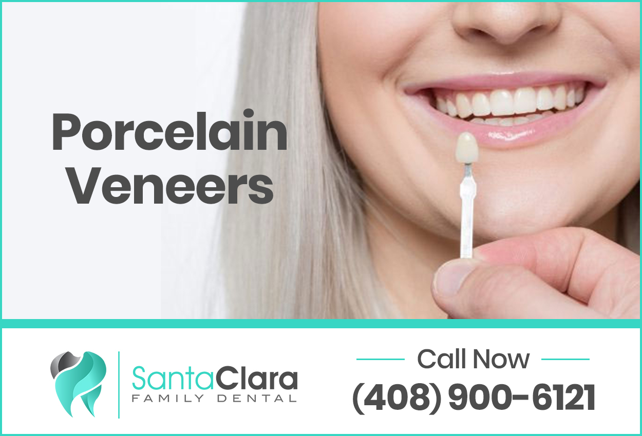 Dental Veneers Near Me | Santa Clara Family Dental