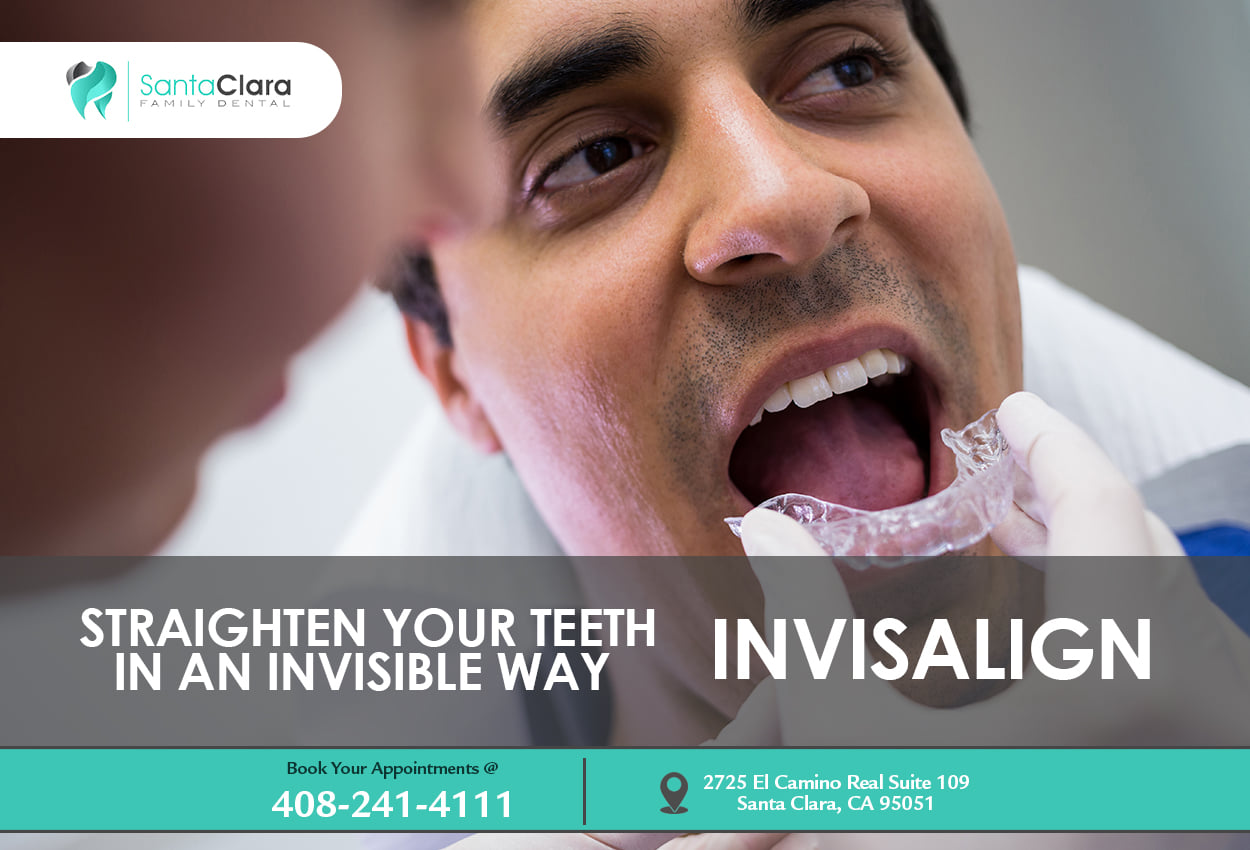 Invisalign Dentist | Santa Clara Family Dental