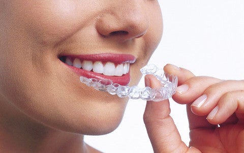 The Benefits of Invisible Dental Aligners: A Comprehensive Guide