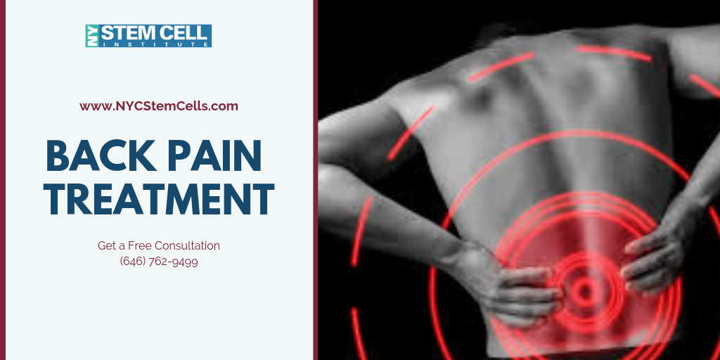 Are Stem Cells a Viable Treatment for Lower Back Pain?