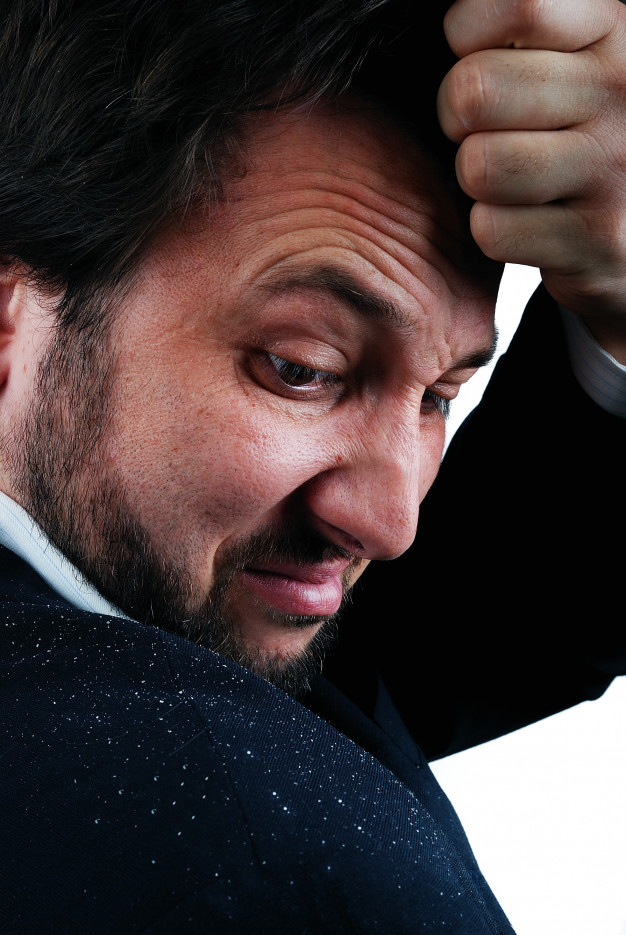 How to Get Rid of Dandruff With Men