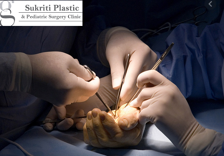 Sukriti Plastic Surgery Clinic for Microvascular and Flap Surgeries