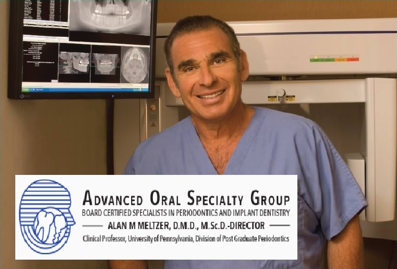 Full Arch Implants in cherry Hill