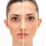 Microblading Carmel