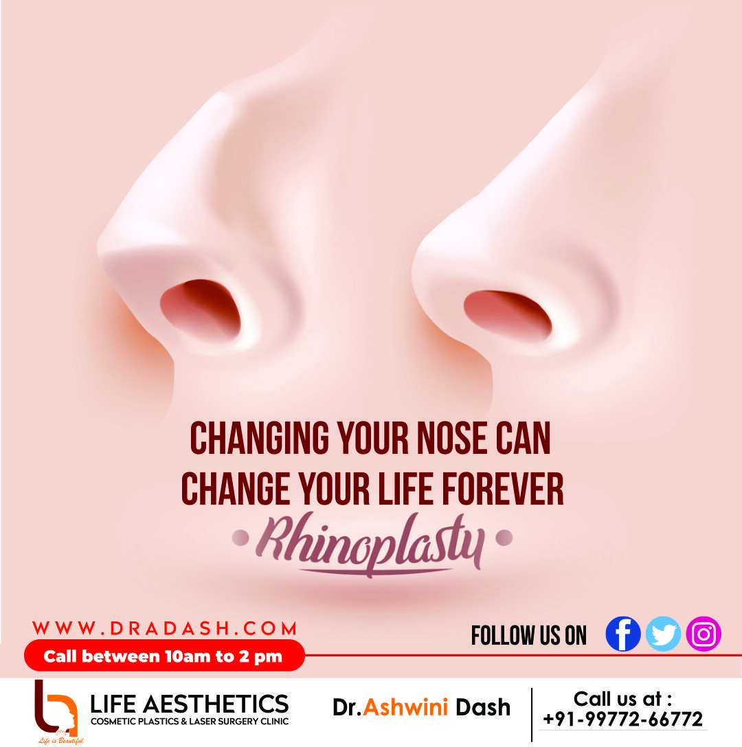 Understand Rhinoplasty Step by Step