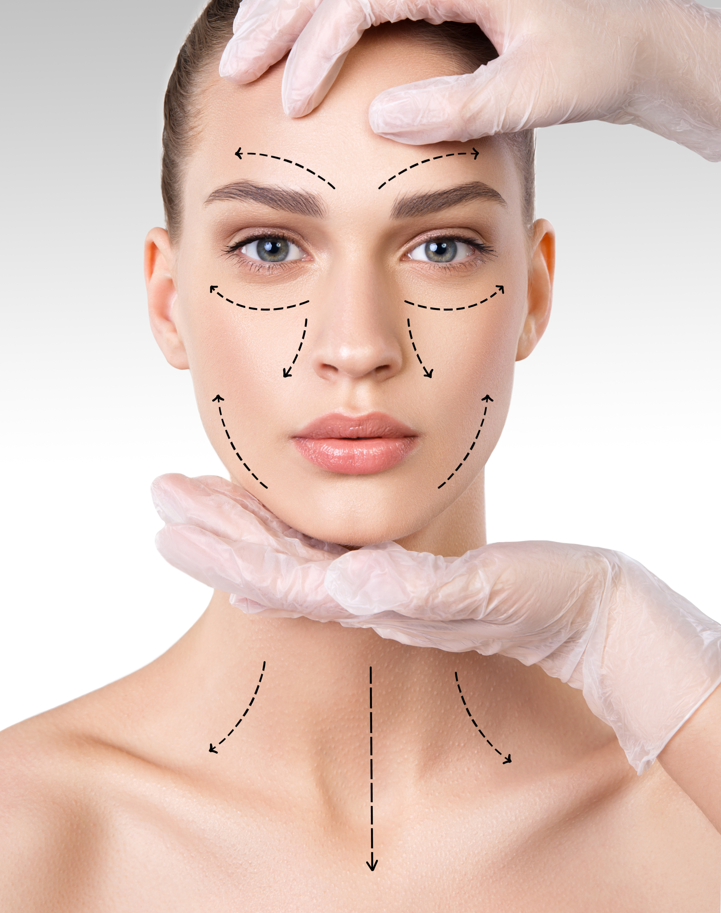 Types of Facelifts