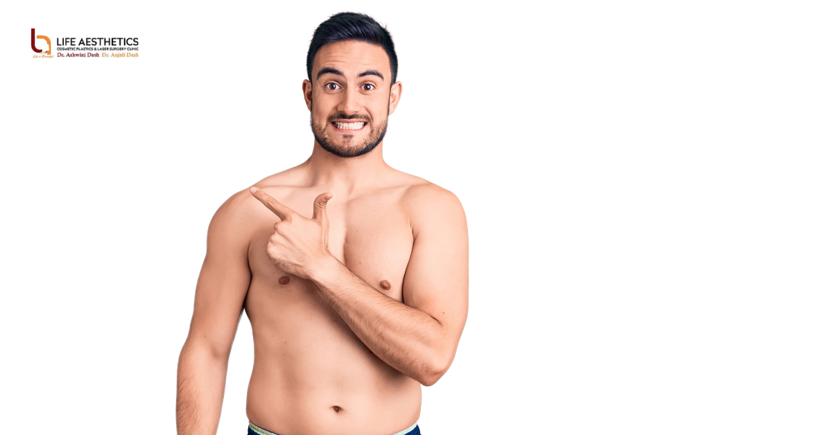 Gynecomastia Treatment: From Diagnosis to Recovery