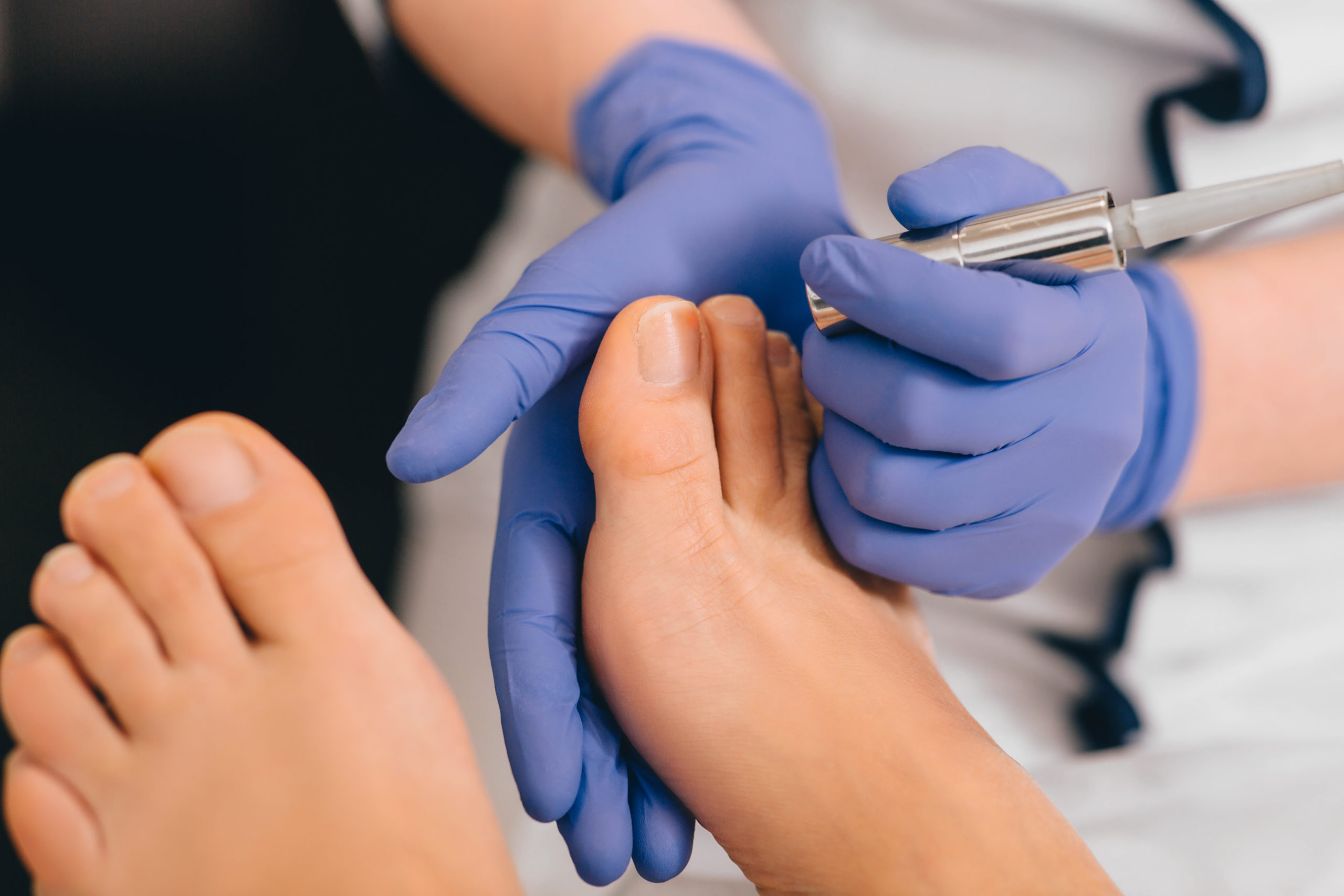 Forces Of Nature Nail Fungus Control Extra Strength