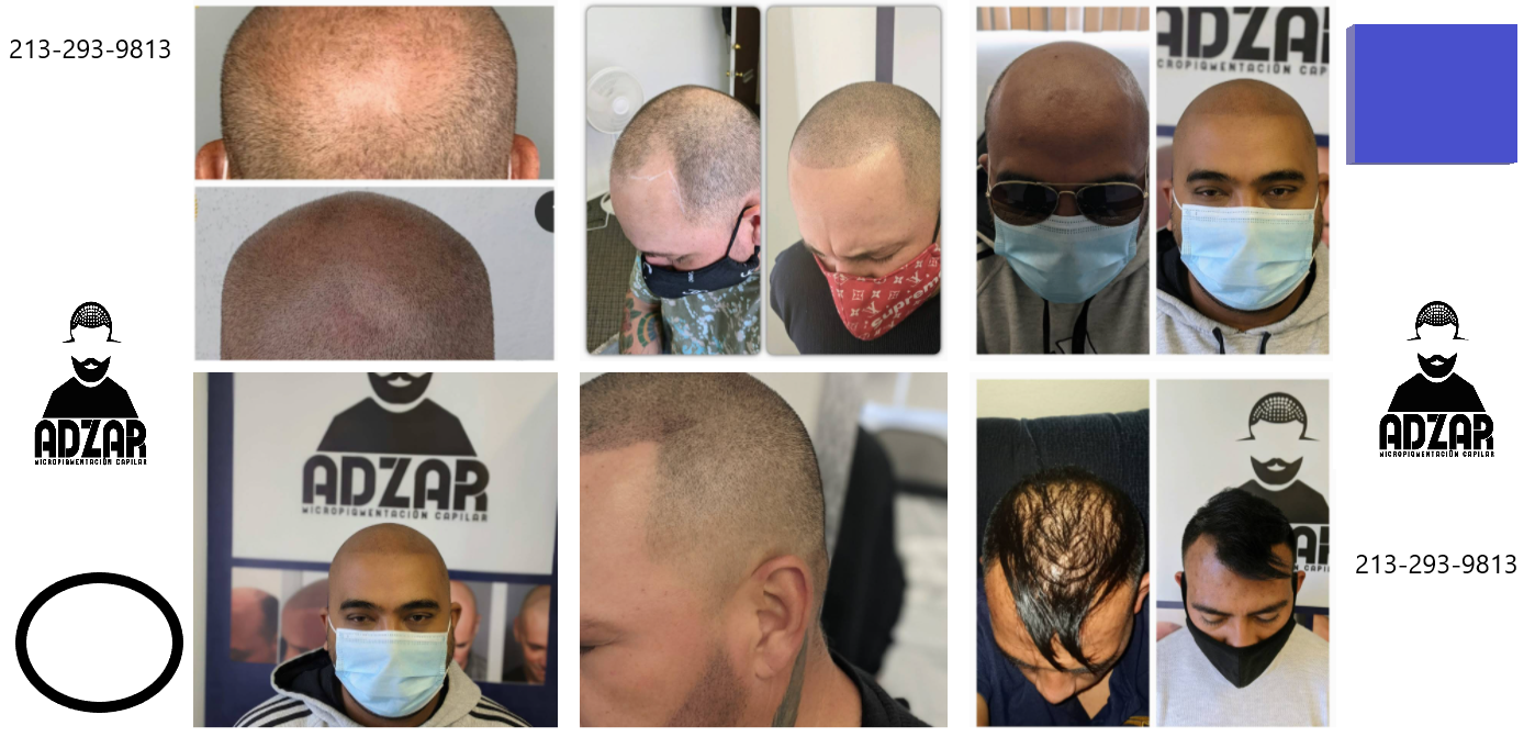 Micropigmentacion Capilar california