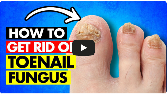 How can you get rid of toenail fungus