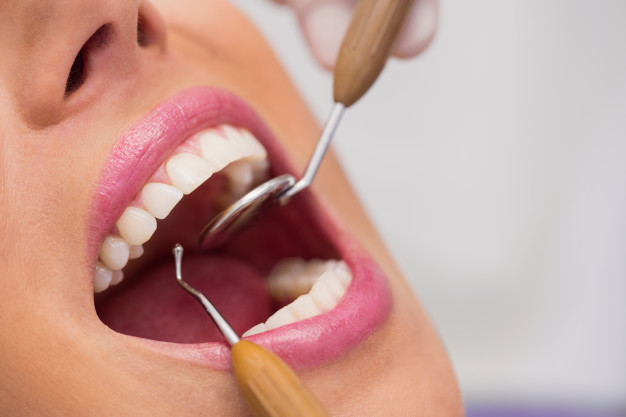 Wisdom Tooth Removal No Insurance Sacramento