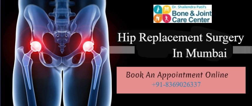 Anatomical Hip Replacement: To improve lifestyle of Sickle Cell Patients requiring Hip Surgery