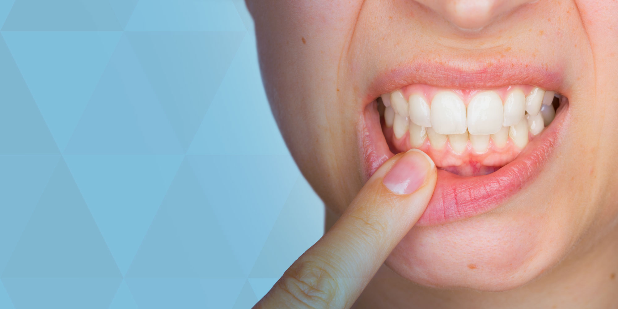 5 Reasons Your Dental Office Near Me Should Offer Laser Dentistry
