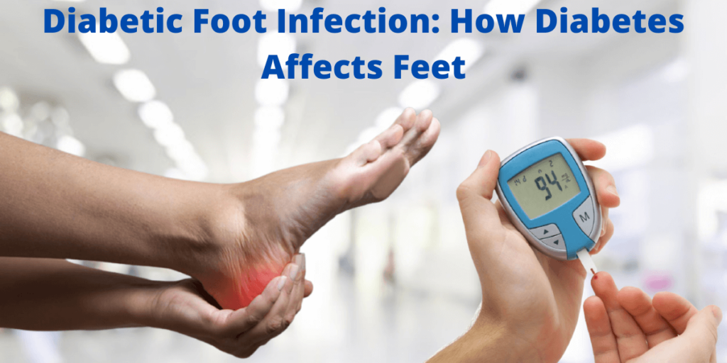 How Diabetes Affects Feet and Causes Diabetic Foot Infection