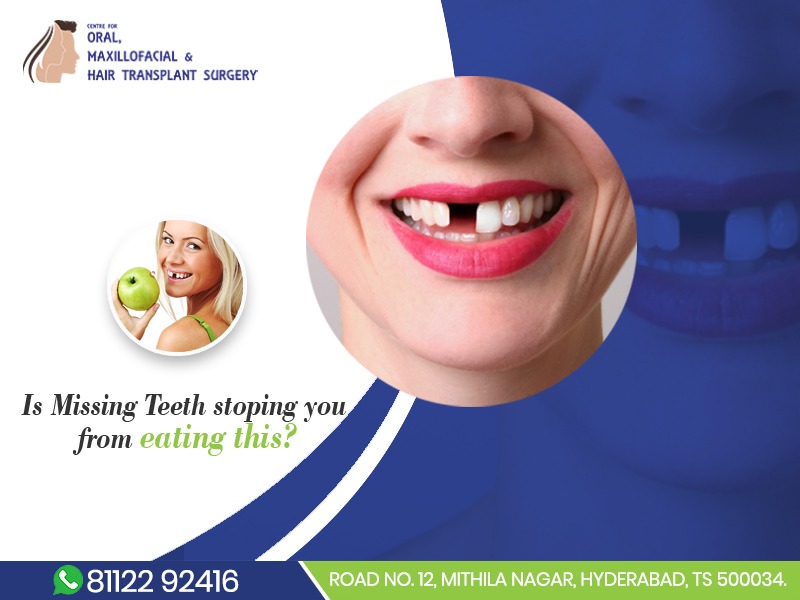 Dental implant cost in Hyderabad