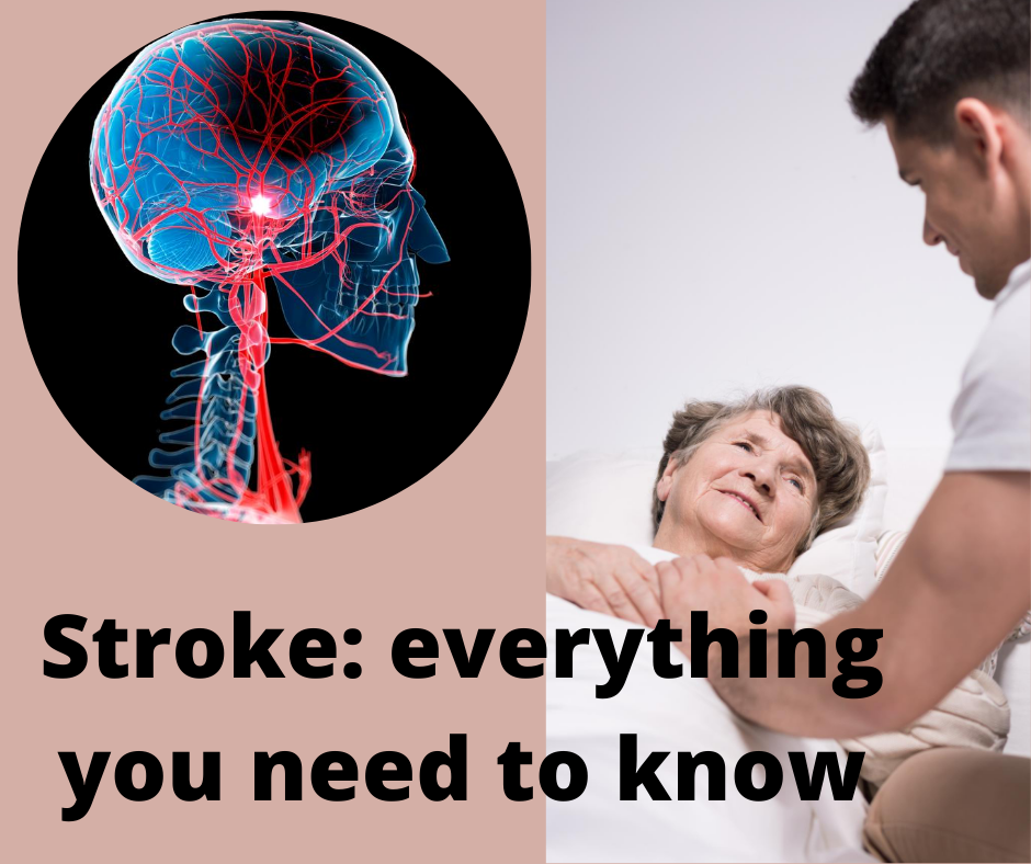 Stroke: everything you need to know