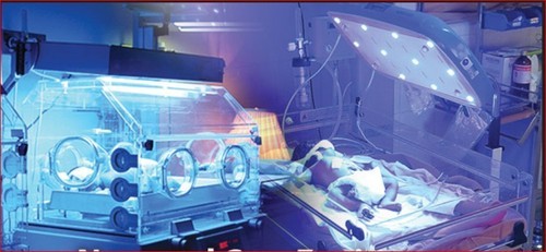 Global Neonatal Care Equipments Market Analysis | Industry Report 2027