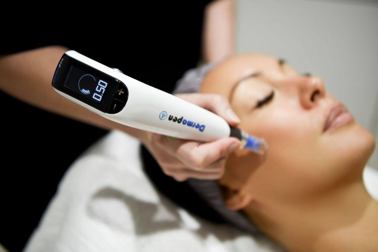 Dermapen treatment