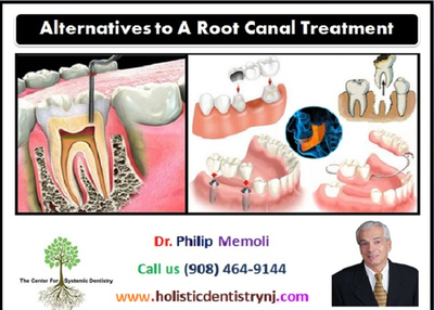 Affordable Root Canal Alternative Treatment – Holistic Dentistry NJ | Dr. Philip Memoli