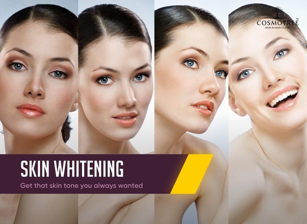 Are Skin Whitening Treatments Worth it?