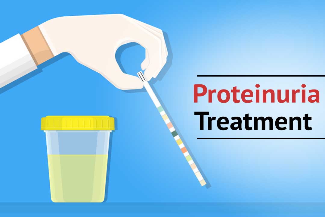 How Proteinuria can be relieved with ayurvedic medicines?