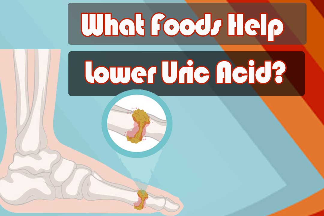 What Foods Help Lower Uric Acid?