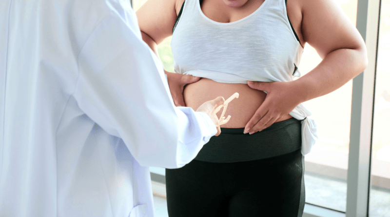 Fast Track to Weight Loss: Unravelling Bariatric Surgery's Impact