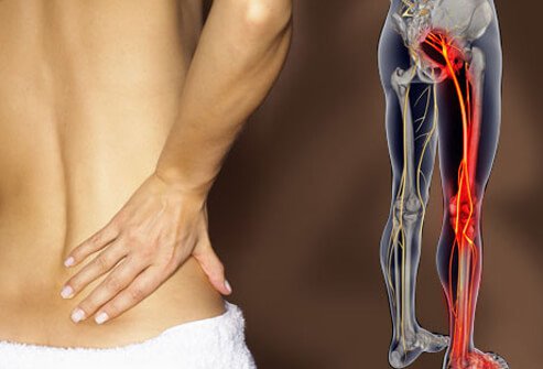 Buy Tramadol high for back pain - purchase tramadol | tramadol shop