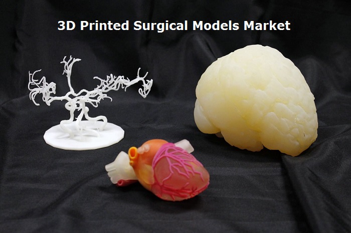 Global 3D Printed Surgical Models Market Current Scenario And Future Growth Analysis By 2026