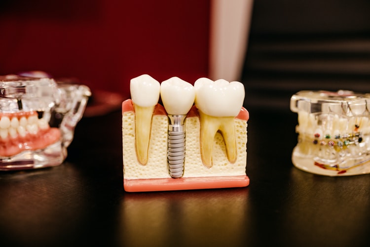 How Technology is Impacting the Dentistry Industry